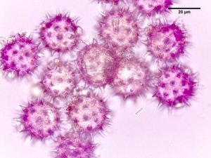 Leica ICC50 HD camera