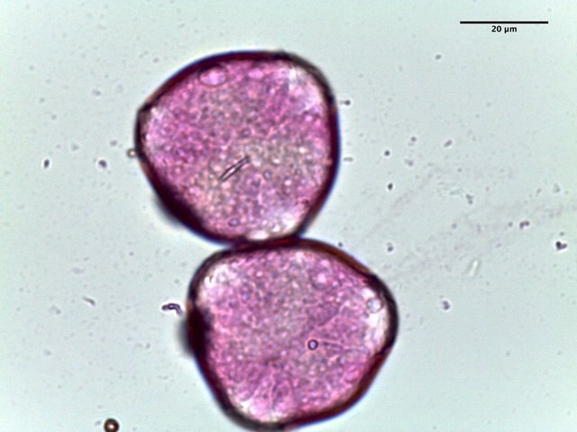 Prunus_spp,_pollen,I_POL488