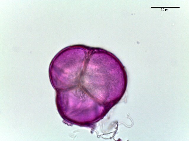 Rhododendron_flammeum,_pollen,I_POL381