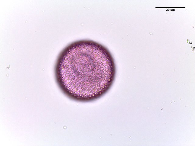 Trillium_stamineum,_pollen,I_POL388